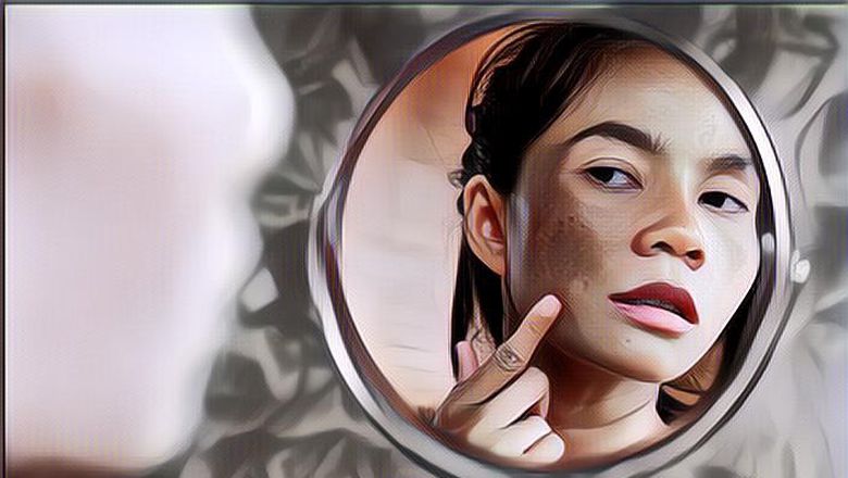 Mengenal Flek Hitam pada Wajah dan Cara Mengatasinya