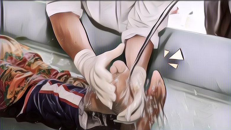 Ini yang Terjadi Saat Jenazah Penganut LGBT Dimandikan, Pelayat Berebut Tali Pocong