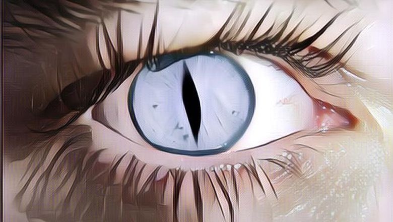 Berbagai Kelainan Langka Pada Mata Manusia