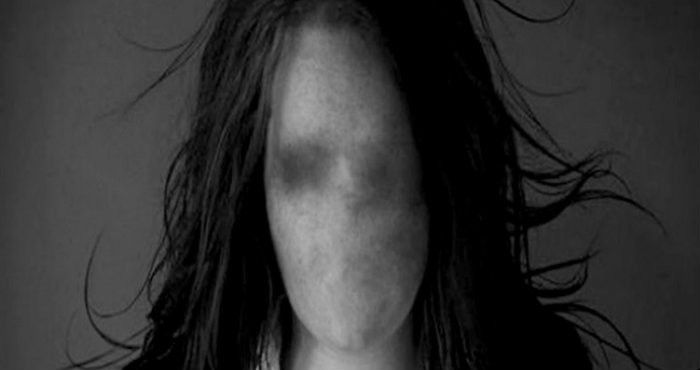 2. Hantu Muka Rata = Flat Face #NoFilter #NoEdit Ghost