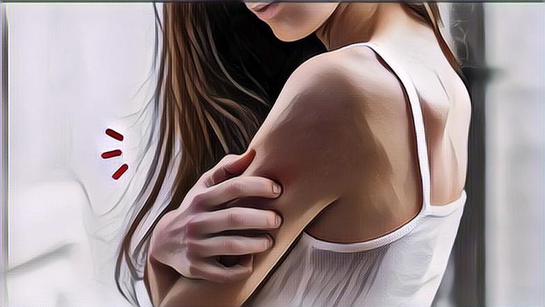 Mengenal Apa itu Prurigo atau Darah Manis, Apa Penyebab dan Bagaimana Menyembuhkannya?