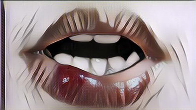 4 Obat Sariawan Alami yang Bisa Kamu Dapatkan Di Rumah