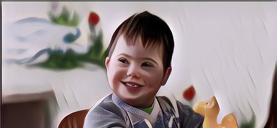 Psikologi Anak Berkebutuhan Khusus, Perlu Perlakuan yang Beda