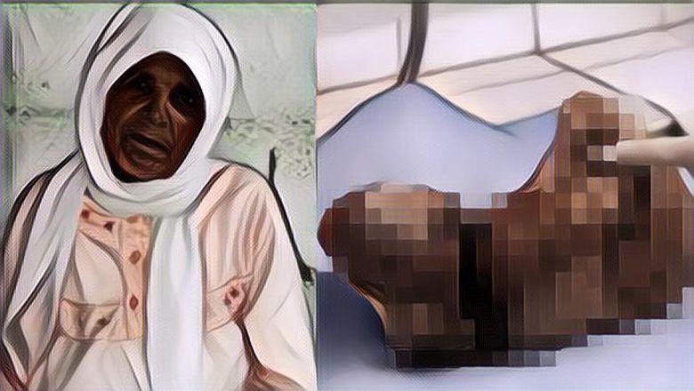 Viral! Nenek Ini Sudah Hamil Selama 46 Tahun Baru Sadar Usai Kontraksi, Kondisi Janinnya Bikin Merinding