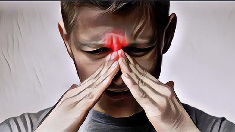 Mengenal Gejala Sakit Kepala Sinus dan Cara Mengatasinya