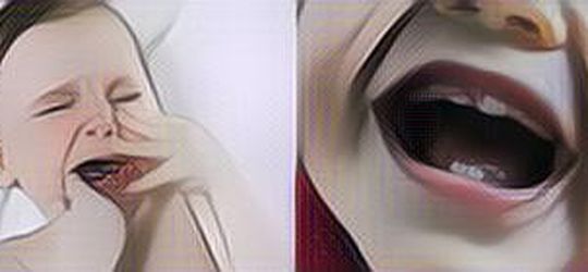 Benarkah Tumbuh Gigi pada Bayi Bisa Bikin Demam? Ini Jawabnya