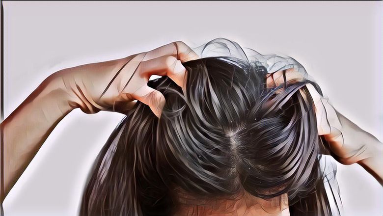Cara Menghilangkan Kutu di Rambut tanpa Merusak dan Alami