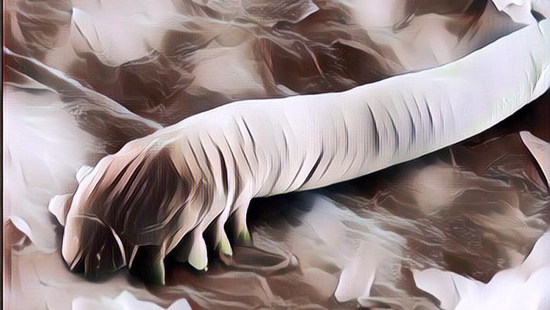 4 Parasit Ada Di Dalam Tubuhmu, Salah Satunya Gampang Cemas