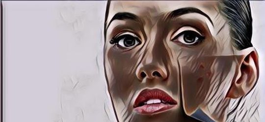 Cara Menghilangkan Bekas Jerawat dan Bintik Hitam, ASAP!