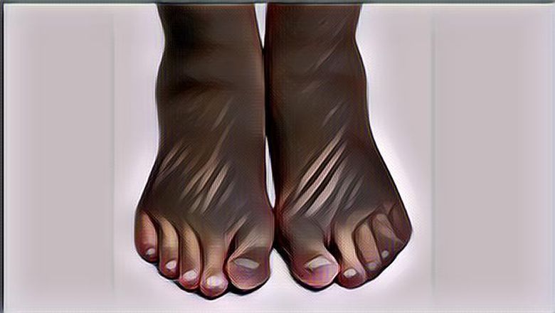 Cara Jitu Hilangkan Bau Kaki, Gausah Panik Ya!