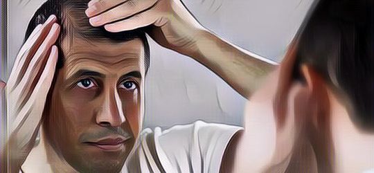 Cara Mencegah Kebotakan Rambut di Usia Muda Menurut Dokter