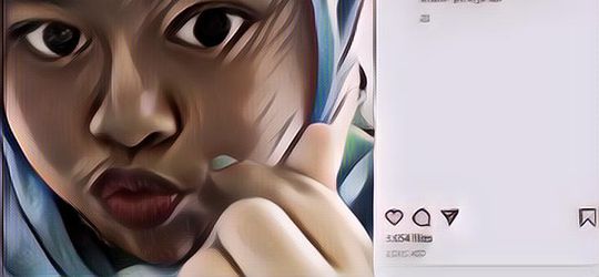 Begini Penjelasan Kekeyi Soal Filler Hidungnya yang Viral