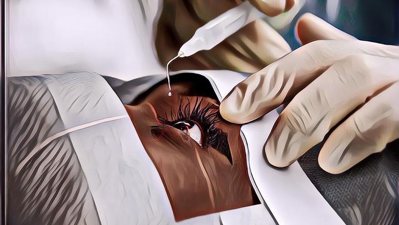 Mengenaskan, Wanita Ini Jadi Korban Malapraktik Oplas, Bola Matanya Ikut Kejahit