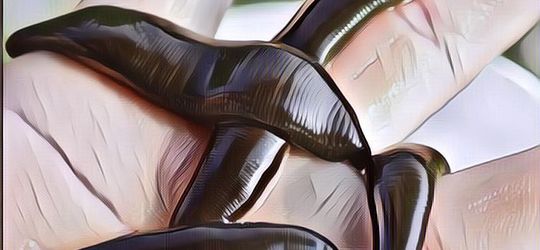 8 Manfaat Terapi Lintah untuk Kesehatan dan Efek Sampingnya