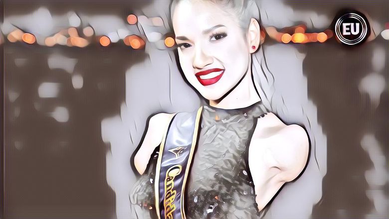 Wanita Ini Cuma Punya Satu Tangan dan Satu Kaki, Kini Sukses Menjadi Seorang Model