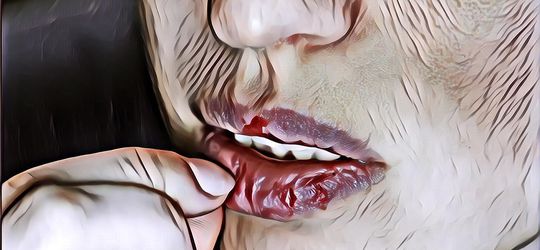 Berkah Ramadan: Bikin Tidak Nyaman, Begini Tips Mengatasi Bibir Kering saat Puasa