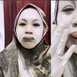 Viral Wanita Bibirnya Mendadak Bengkak 3 Jam Sebelum Akad Nikah! Begini Kondisinya
