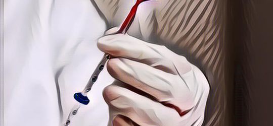 Waduh! IUD dan Pil KB Ternyata Tingkatkan Risiko Wanita Terkena Kanker Payudara, Ungkap Studi Terbaru