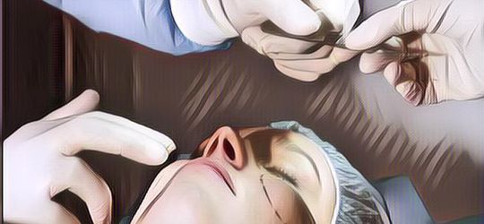 Ini Ternyata Bahaya Operasi Plastik Gagal, Bisa Sampai Merenggut Nyawa