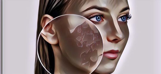 Kulit Kering Karena Ruangan AC, 5 Bahan Ini Bisa Jadi Solusi Jaga Kulit Tetap Lembab