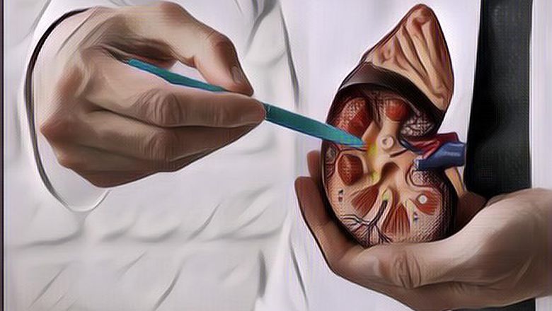 Konsumsi Rutin 5 Makanan Ini untuk Kesehatan Ginjalmu!