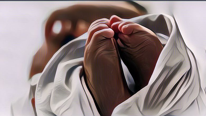 Beneran Nyata! Ada Bayi Lahir dengan Mata Satu di Yaman, Begini Penampakannya