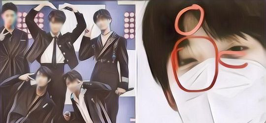 Tega! Diduga Dipukul Leader Grupnya, Idol Ini Ketahuan Datang Ke Acara Dengan Muka Lebam