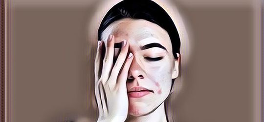 4 Kebiasaan yang Harus Dihindari Saat Kulit Breakout