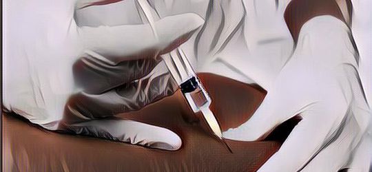 Serem! Petugas Laboratorium Ini Lagi Ambil Darah Pasien, Jarum Suntik Mendadak Patah, Ternyata Penyebabnya Ini