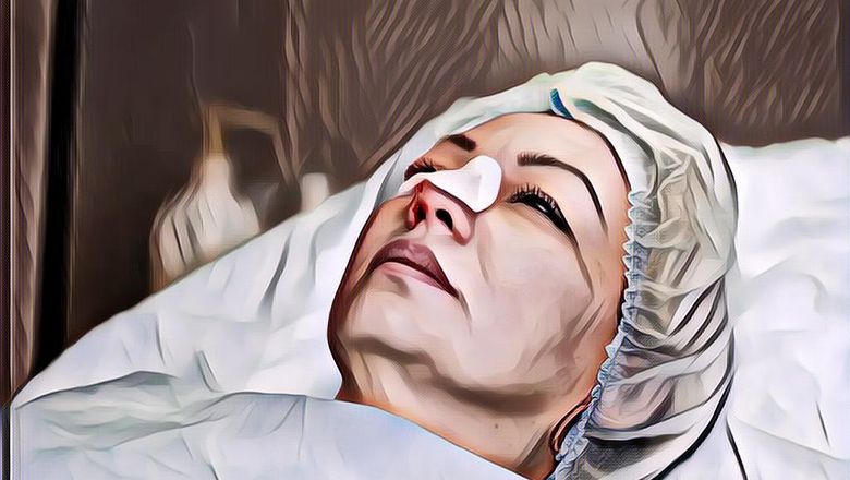 Berencana Operasi Hidung Agar Mancung? Kenali Dulu Prosedur dan Resikonya