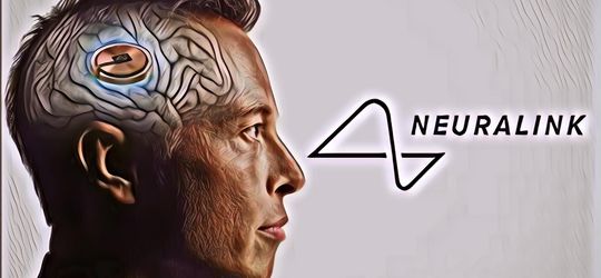 Perusahaan Elon Musk Berhasil Tanam Chip ke Otak Manusia untuk Kedua Kalinya