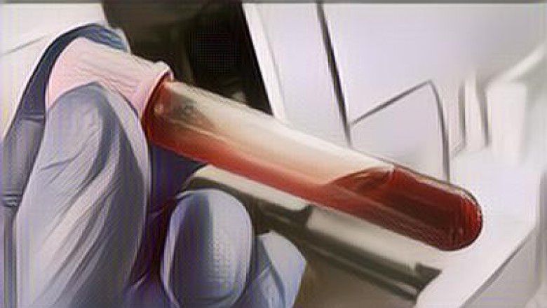 Bikin Heboh! Banyak Masyarakat China Jalani Terapi Pemurnian Darah Agar Bisa Berumur Panjang