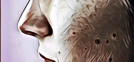 Cara Menghilangkan Bintik-bintik di Wajah, Ini Jurus Jitunya!