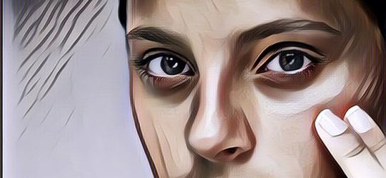 Bikin Makin Cantik, Begini Cara Mengatasi Area Mata Gelap