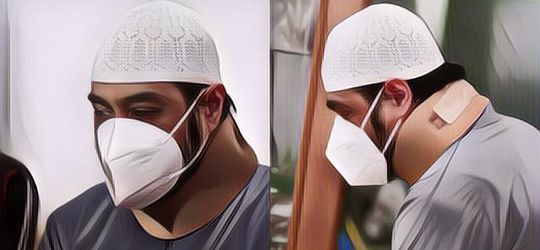 Ngeri! Deretan Artis yang Alami Pecah Pembuluh Darah di Otak, Kondisinya Memprihatinkan