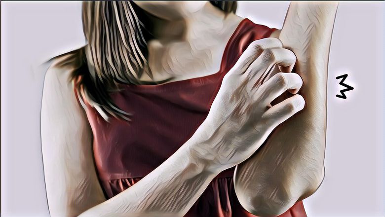 Awas, 7 Kondisi Kulit Ini Bisa Membahayakan Nyawa, Deteksi sebelum Terlambat, Ya!