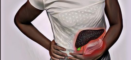 Mengenal Apa itu Sirosis Hati yang Membuat Tamara Geraldine Divonis Hanya Bisa Bertahan Selama 8 Bulan