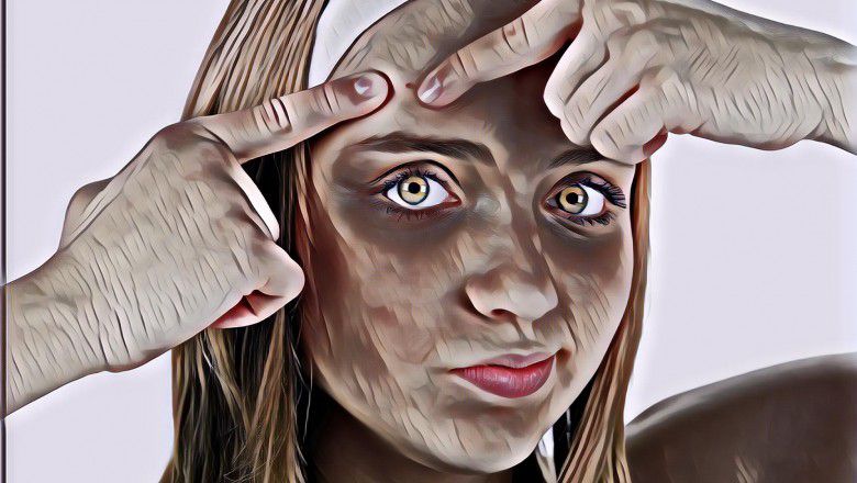 Cara Menghilangkan Jerawat dan Bekas Jerawat yang Oke Banget!