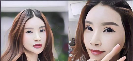 Begini Reaksi Sarwendah Soal Perceraiannya dengan Ruben Onsu Pasca Oplas di Korea