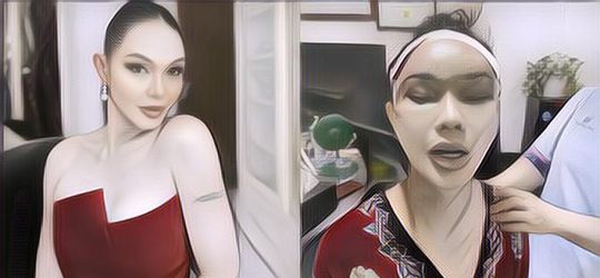 Begini Hasil Oplas Wajah Bunda Corla yang Habiskan Biaya Rp 1,5 M