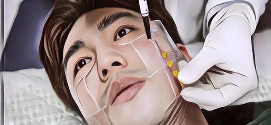 Oplas Bagi Kaum Lelaki, Lebih Mudah Dipercaya