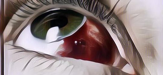 Mata Merah Sebelah: Begini Penyebabnya Gengs