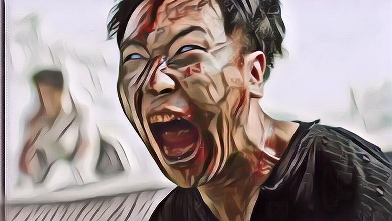 Ga Ada Obat! Ini 5 Daftar Penyakit Paling Mematikan di Dunia