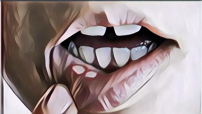 Sedang Sariawan? Coba Obati dengan 7 Bahan Alami yang Mudah Didapat Ini Deh!