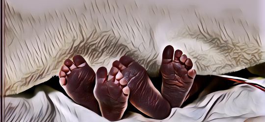 Twin to Twin Transfusion Syndrome Penyebab Bayi Irish Bella dan Ammar Zoni Meninggal