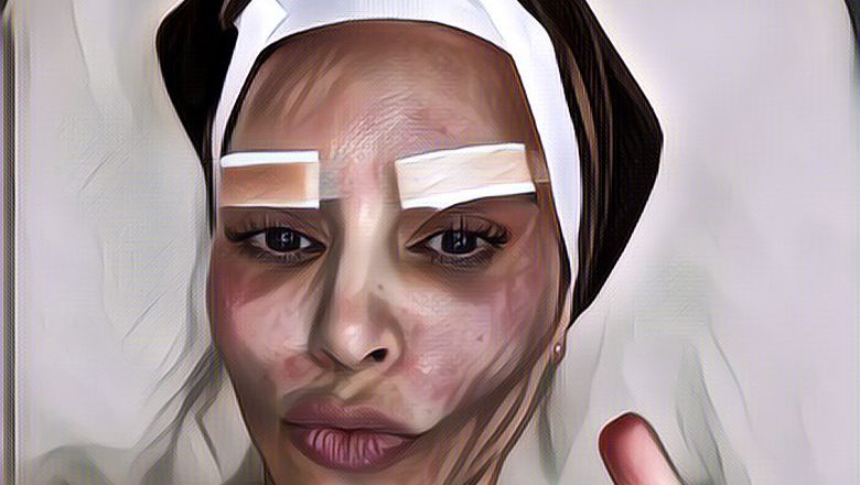 Heboh Kim Kardashian Lakukan Perawatan Wajah di Korea dengan Cara Ekstrem: Pakai Suntik Darah