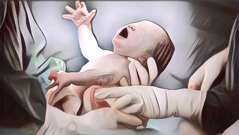 Heboh! Bayi Bermata Satu Lahir Di Yaman, Endingnya Memilukan Keluarga Harus Ikhlas