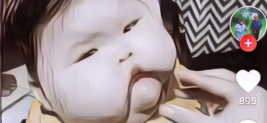 Heboh Ada Bocah 1 Tahun Berat Badannya Mencapai 27 Kg: Apa Kata Dokter?