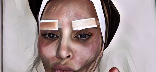 Heboh Kim Kardashian Lakukan Perawatan Wajah di Korea dengan Cara Ekstrem: Pakai Suntik Darah