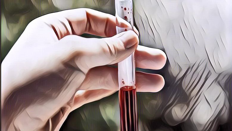 Sifat Menurut Golongan Darah, Kalian yang Mana Nih?